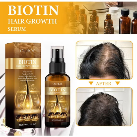 OUHOE Biotin Hair Serum, Hair Regrowth Spray
