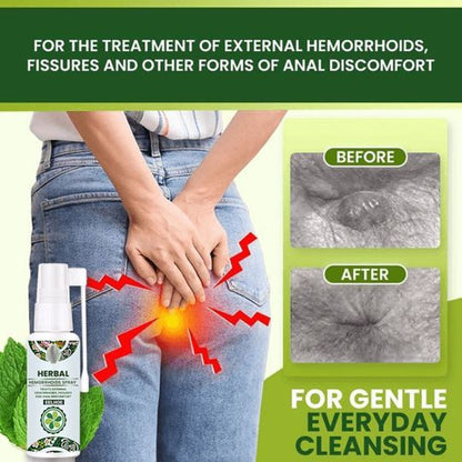 30ml Hemorrhoid Treatment Spray Natural