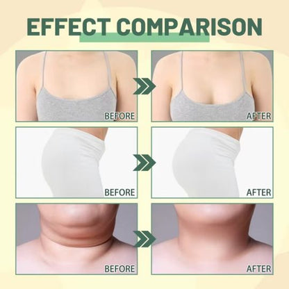 OUHOE 30ml Body Shaping Oil