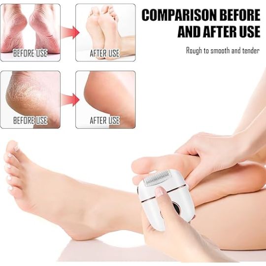 Pedicure Electric Callus Remover, Callus Removal Foot
