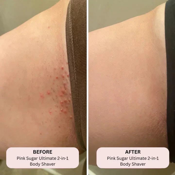 THE ULTIMATE BIKINI TRIMMER - SAMFARS™