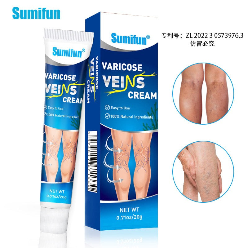 Varicose Veins Treatment for Legs