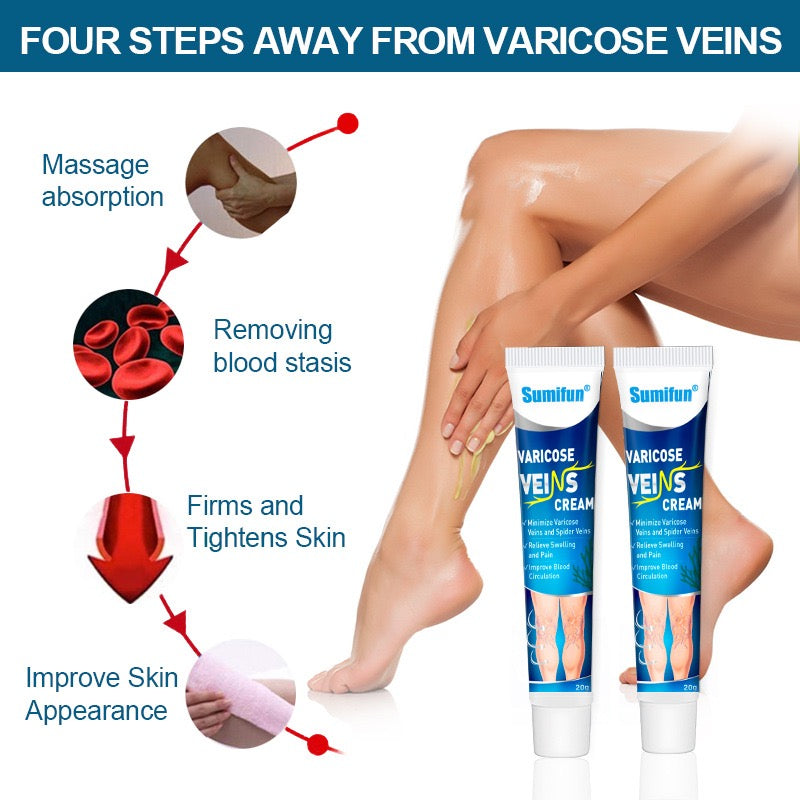 Varicose Veins Treatment for Legs